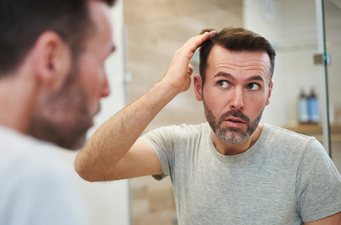 hair loss for men